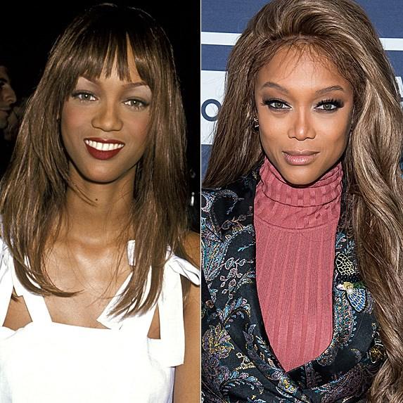 Do you think that plastic surgery is helping peoples confidence?