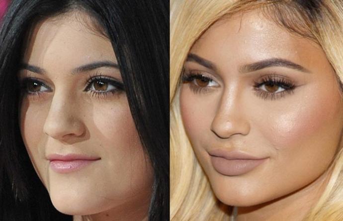 Do you think that plastic surgery is helping peoples confidence?