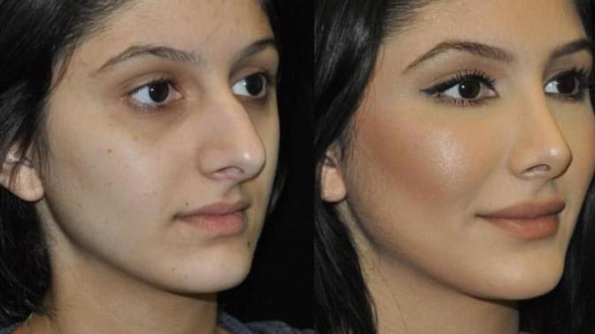 Do you think that plastic surgery is helping people's confidence?