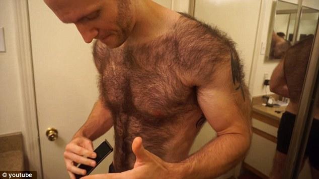 Does an ridiculously hairy person have choices in dating?