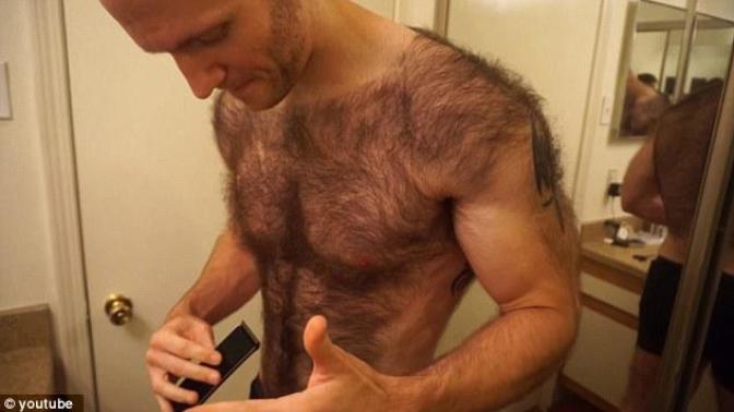 Does an ridiculously hairy person have choices in dating?