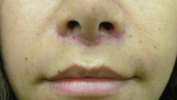How do you feel about about a girl with a visible scar on her face?