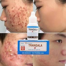 A Girl with a Great Body & Pretty Face, but Bad Acne. Thoughts?