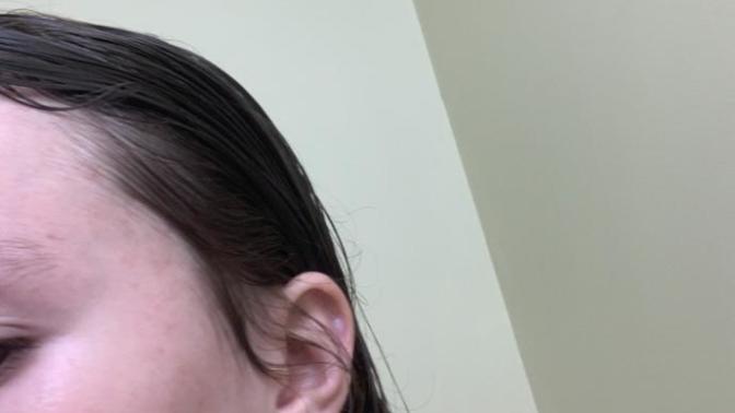 Is this a birthmark?