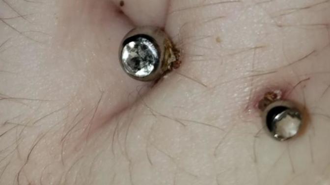 Update on my two month old navel piercing, really crusty, is this okay?