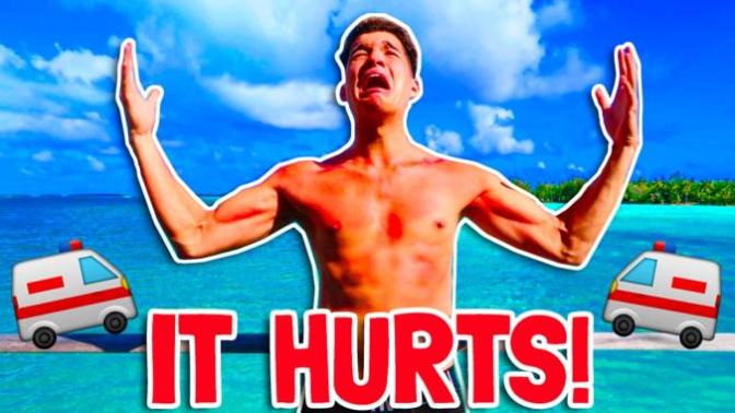 Do You Get Sunburned Easily?