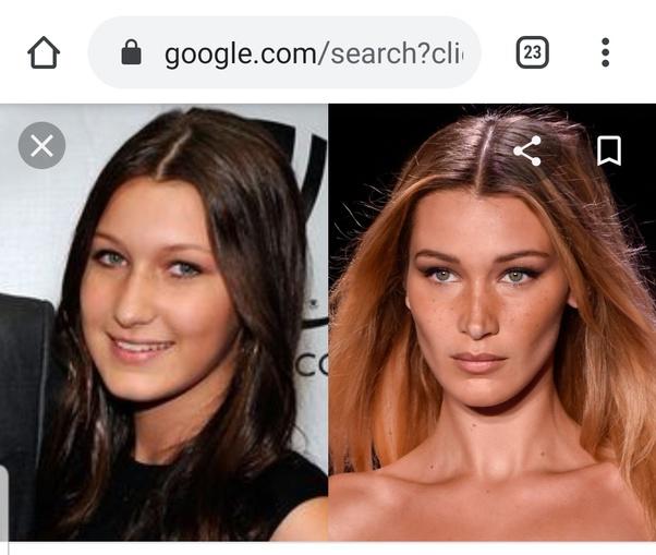 Would you ever consider plastic surgery if you could afford it?