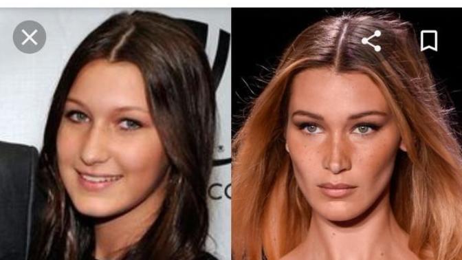 Would you ever consider plastic surgery if you could afford it?