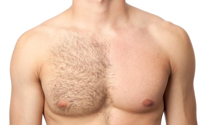 Body hair on boys. Yay or nay?