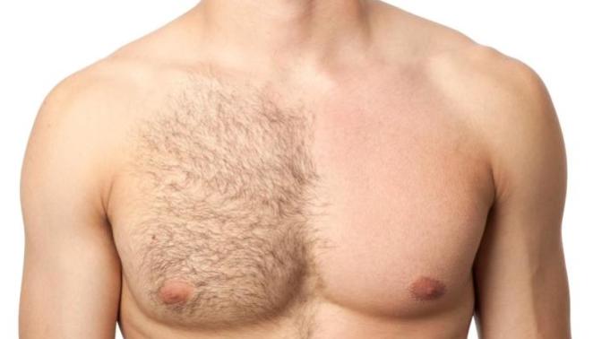Body hair on boys. Yay or nay?