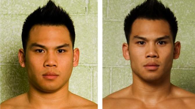 Do guys get insecure of having chubby cheeks?