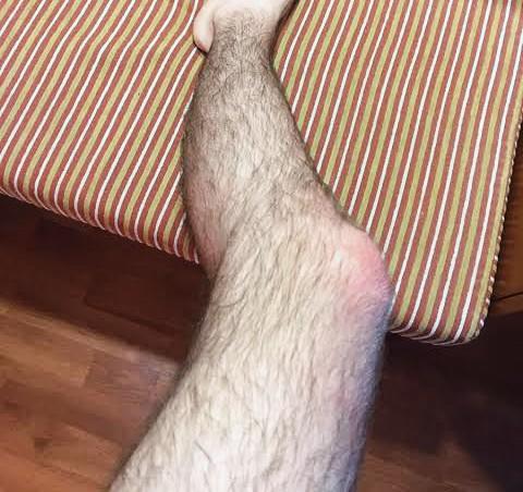 Skinny built having hairy chest, better shave it?