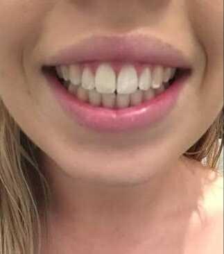 What looks better?