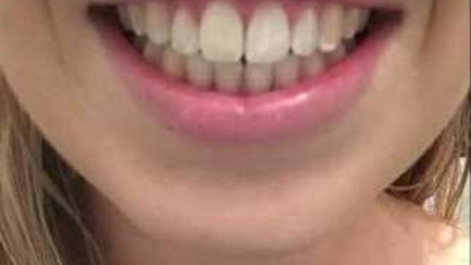 What looks better?