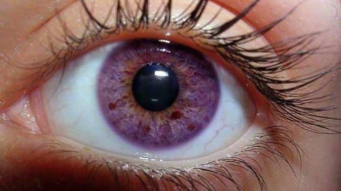 Is it possible for humans to have purple eye colors?