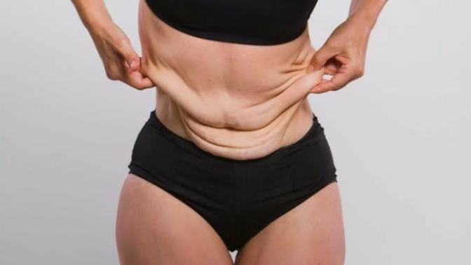 Will I get loose skin if I lose 30kg?