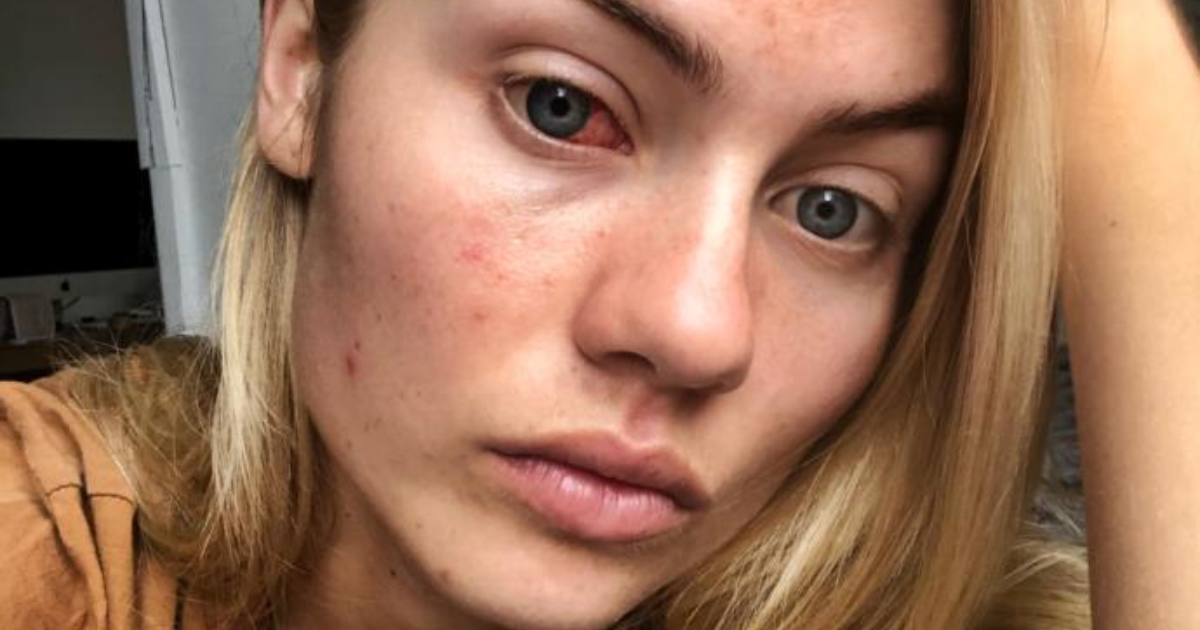 Do You Think Foundation Is Bad For Your Skin GirlsAskGuys