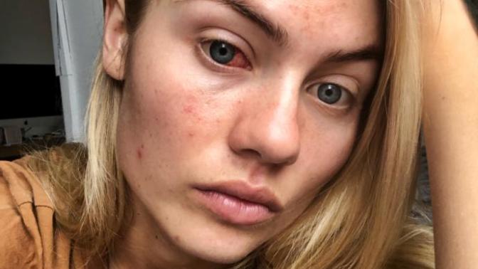Do you think foundation is bad for your skin?