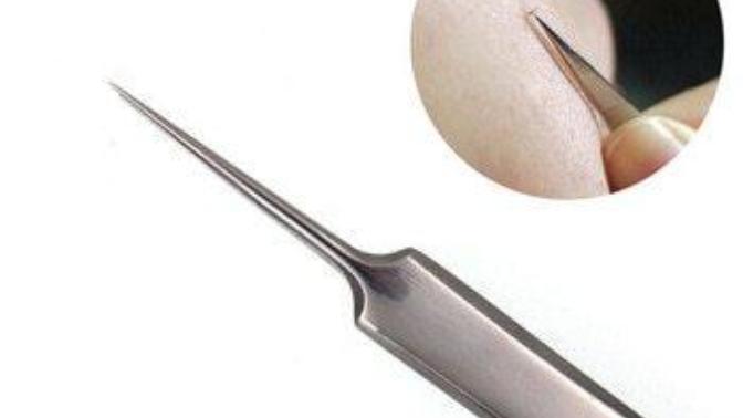 Have you ever performed surgery on yourself?