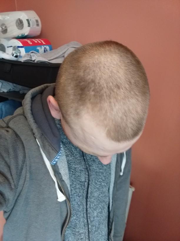 Any doctors in the house? Am I losing my hair?