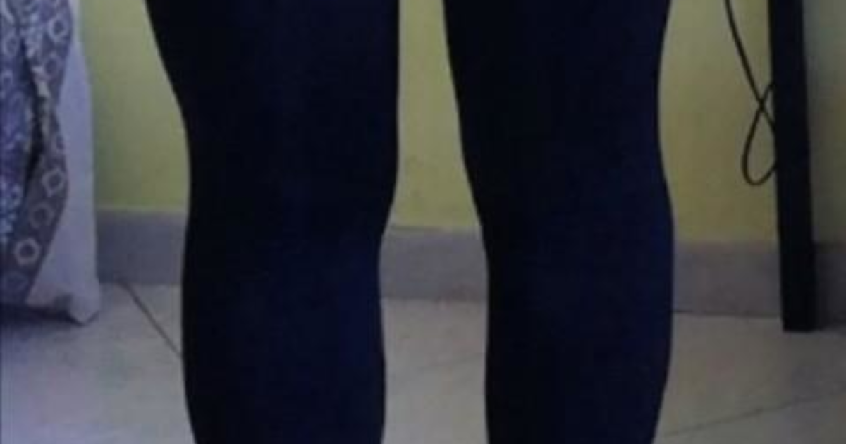 Why is my right leg bigger than the other (see pic)? GirlsAskGuys