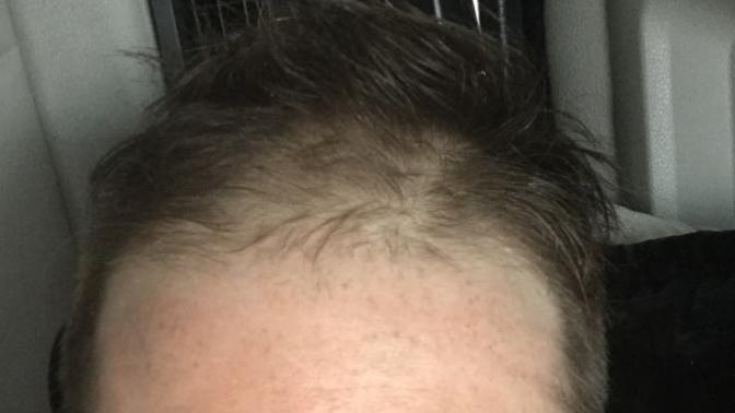What should this man do with his thinning hair?