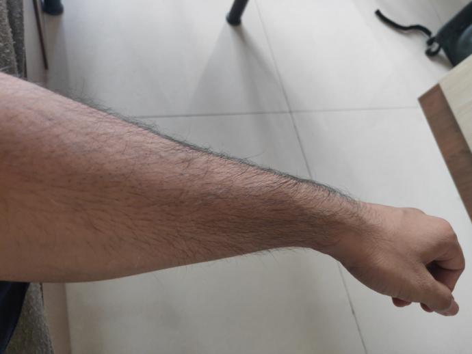 Do you think she should wax (check description)?