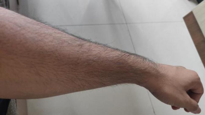 Do you think she should wax (check description)?