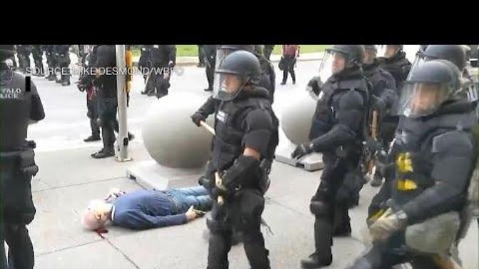 Cops shoved elderly man who is 75 years old to the ground causing him to bleed. Your thoughts?