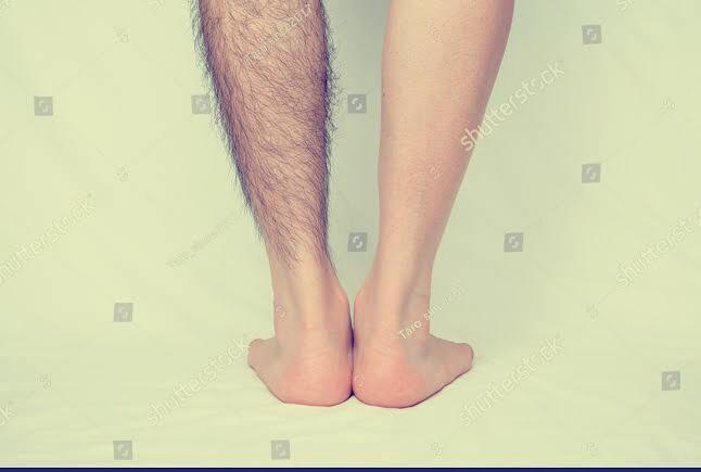 What kind of legs do you love to see on men wearing shorts in public?
