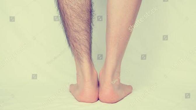 What kind of legs do you love to see on men wearing shorts in public?