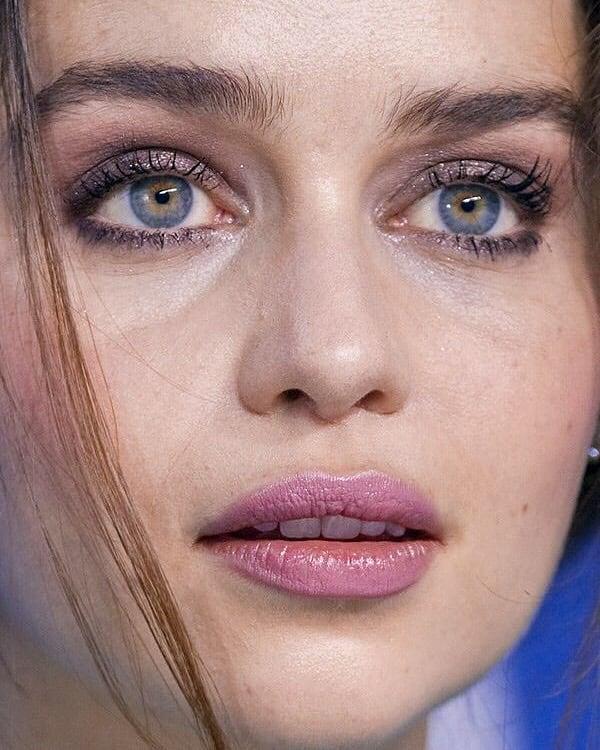here Id say blue despite the central heterochromia
