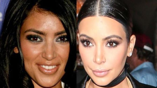 Is there anyone beautiful who hasn’t had plastic surgery?