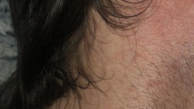 Do I have split ends?