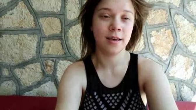 Does she look like she has down's syndrome?