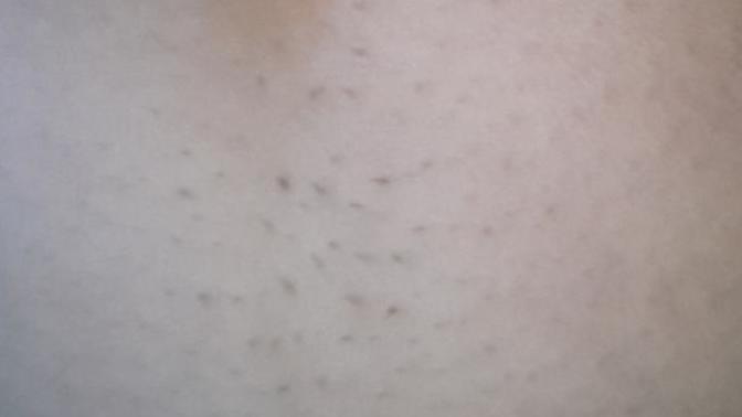 Girls who have belly button hair, help?