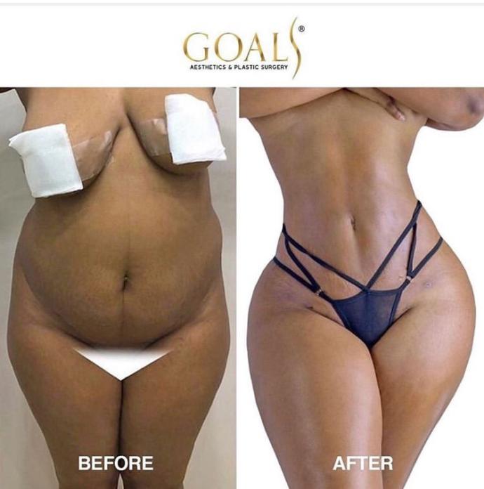 What Are Your Feelings About Plastic Surgery?