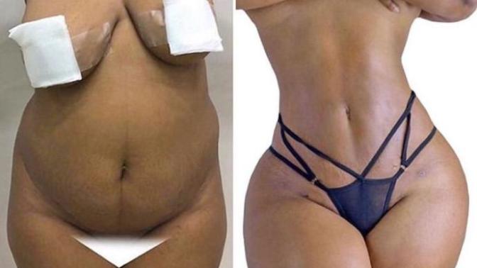 What Are Your Feelings About Plastic Surgery?