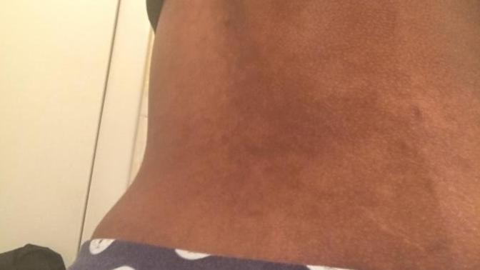 Is there something wrong with my back?