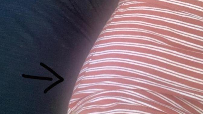 My hip/leg bone pop should I bee concerned (pic)?