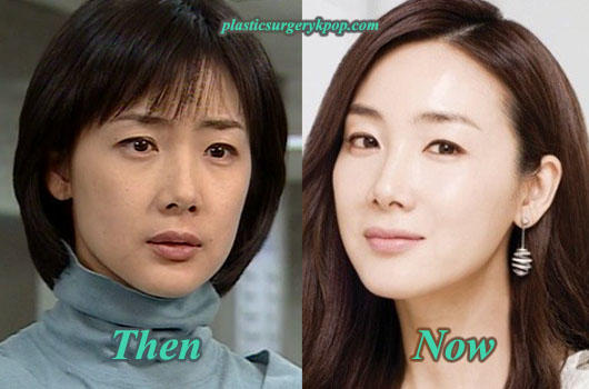 Why do white women looks older than their age compared to Asians?