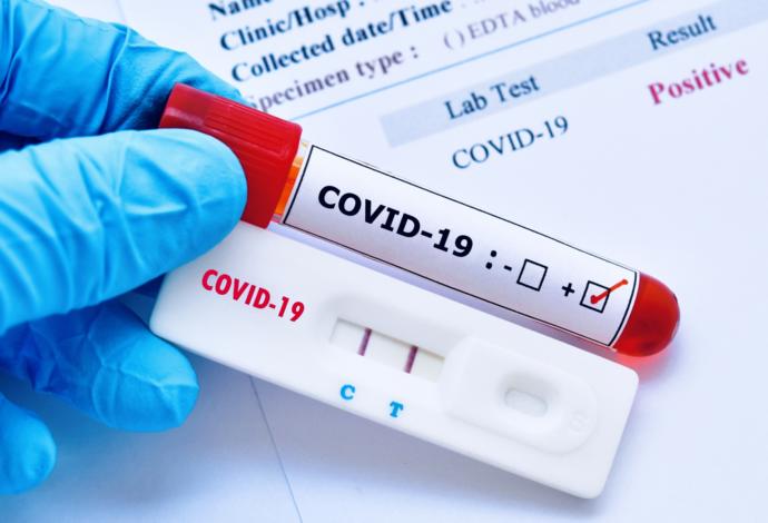 Have You Been Tested For COVID-19?