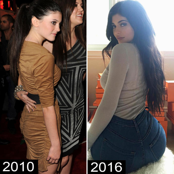 Why do MEN say theyre AGAINST UNNATURAL BEAUTY but still crack on W women who went UNDER the knife?