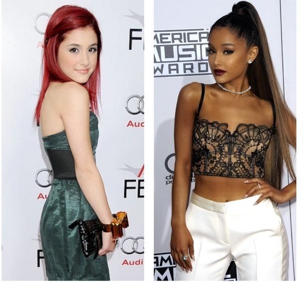 Why do MEN say theyre AGAINST UNNATURAL BEAUTY but still crack on W women who went UNDER the knife?