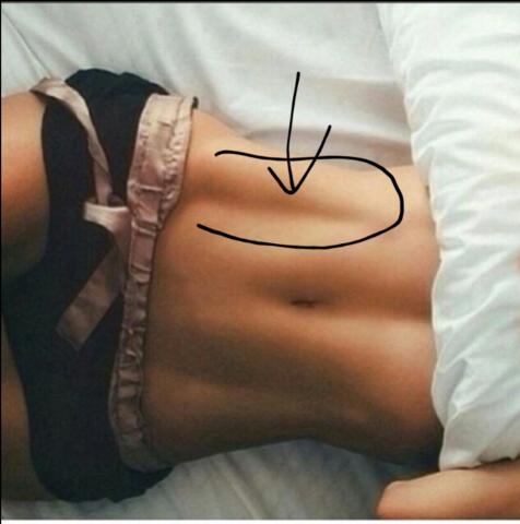Why do I have lines on my stomach?