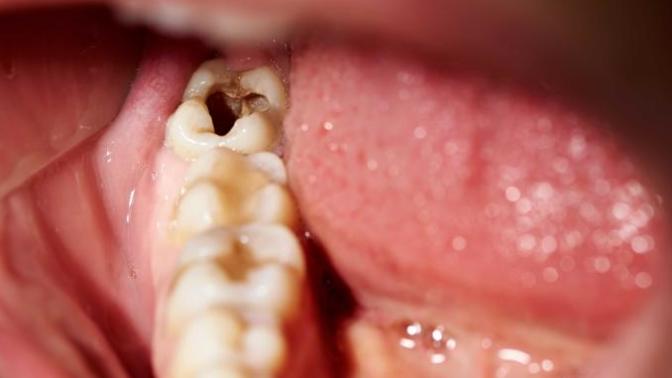 Would you kiss someone who has teeth problem?