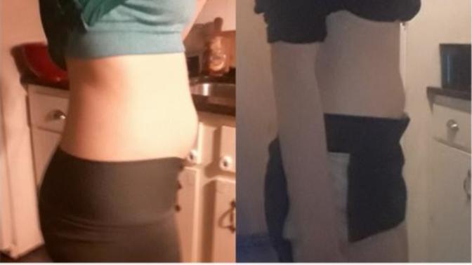 One year later. How's my weight loss?