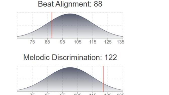 What is your musical IQ?
