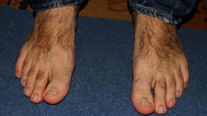 Are you so hairy that you have to shave your feet?