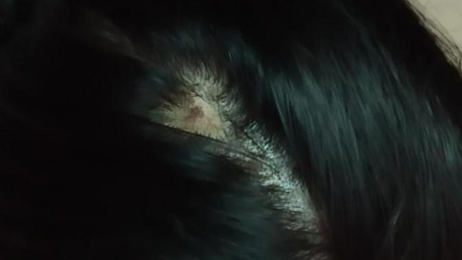 Help!! is there any solution for my scalp?
